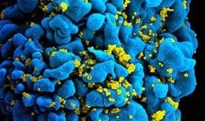 450px-HIV_H9_T-cell.jpg 450px HIV H9 T cell