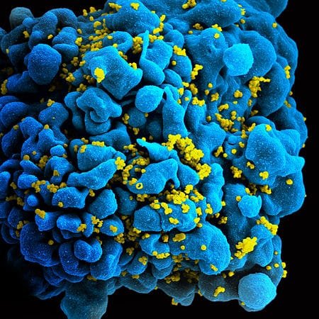 450px HIV H9 T cell