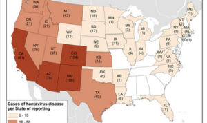 Hantavirus US